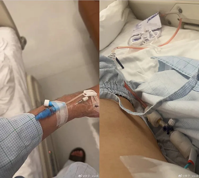 Xiao8 is currently in the hospital, and TI12 is set to begin in a month 1